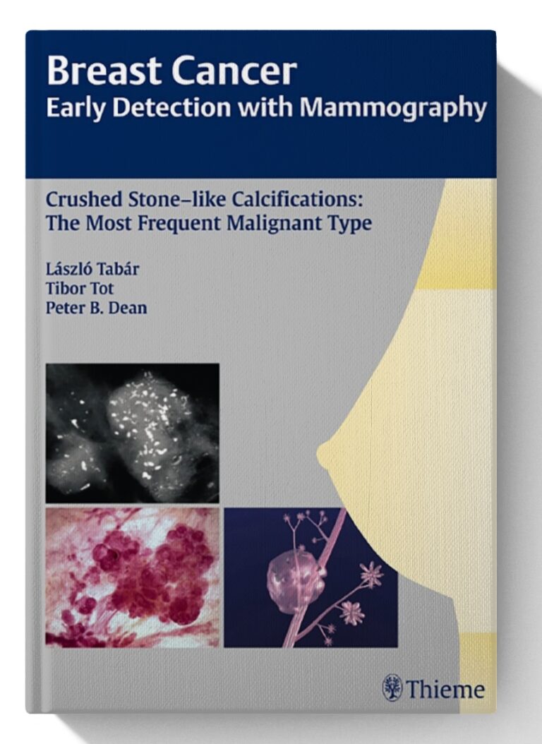 Breast Cancer: Early Detection with Mammography: Crushed Stone-like ...