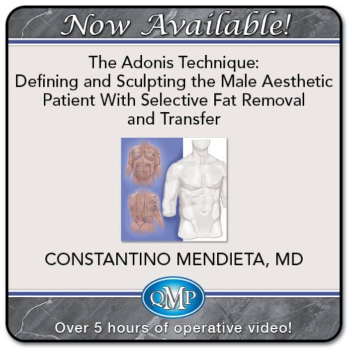 QMP The Adonis Technique Defining and Sculpting the Male Aesthetic Patient With Selective Fat Removal and Transfer 2025