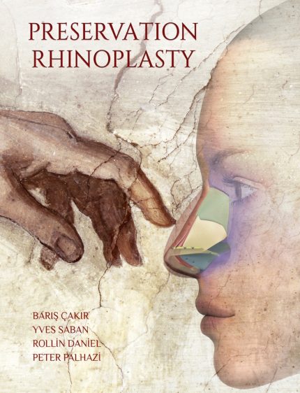 Preservation Rhinoplasty - Barış Çakır, Yves Saban, Rollin Daniel, Peter Palhazi - 2018