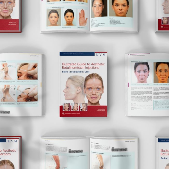 Illustrated Guide to Aesthetic Botulinum Toxin Injections: Basics / Localization / Uses (Aesthetic Methods for Skin Rejuvenation) - Image 2