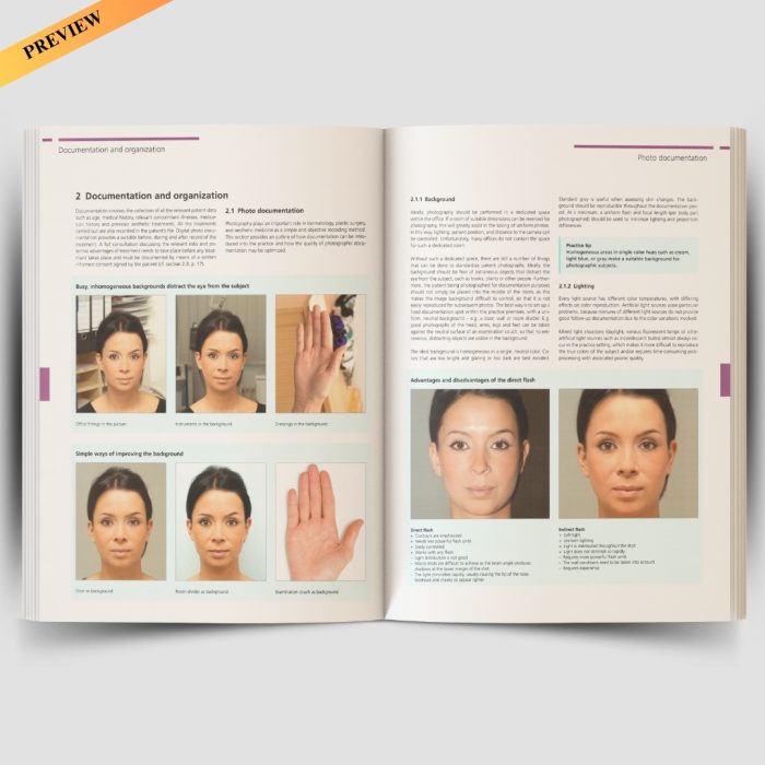 Illustrated Guide to Aesthetic Botulinum Toxin Injections: Basics / Localization / Uses (Aesthetic Methods for Skin Rejuvenation) - Image 6