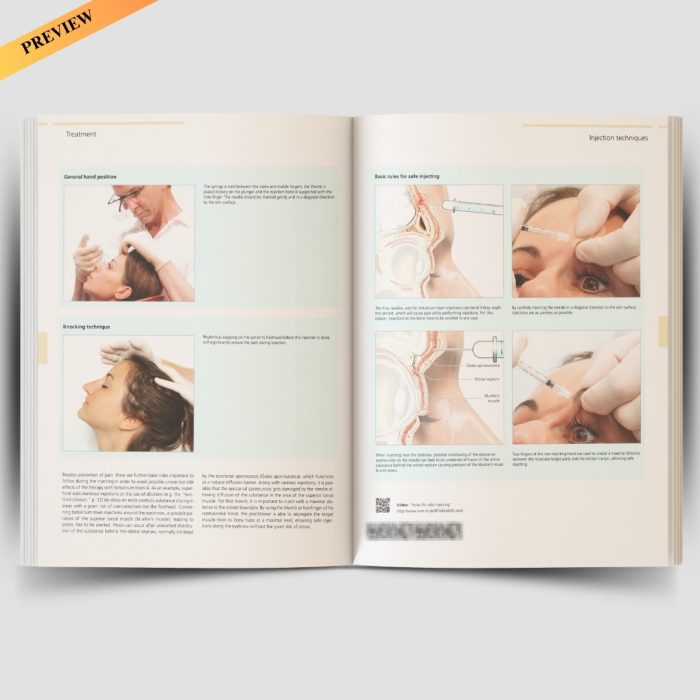 Illustrated Guide to Aesthetic Botulinum Toxin Injections: Basics / Localization / Uses (Aesthetic Methods for Skin Rejuvenation) - Image 3
