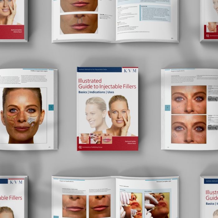 Illustrated Guide to Injectable Fillers: Basics, Indications, Uses – (High quality scanned version) - Image 2