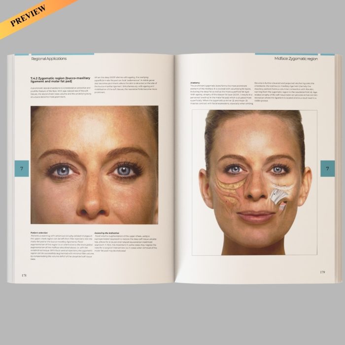 Illustrated Guide to Injectable Fillers: Basics, Indications, Uses – (High quality scanned version) - Image 3