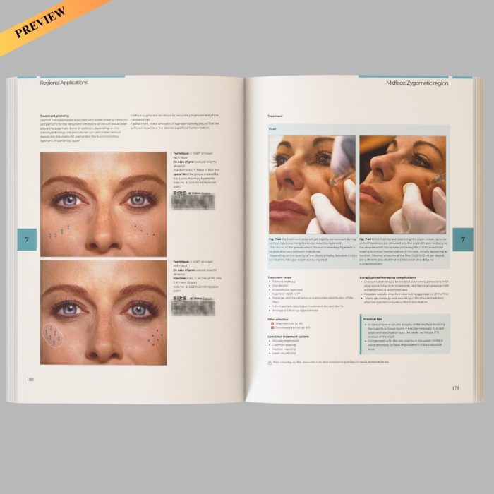 Illustrated Guide to Injectable Fillers: Basics, Indications, Uses – (High quality scanned version) - Image 4