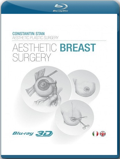 Aesthetic Breast Surgery (Constantin Stan)
